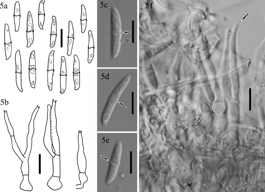 Представитель Семейства Plectosphaerellaceae
